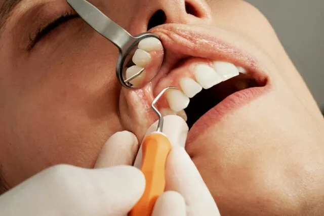 Photo tooth decay prevention