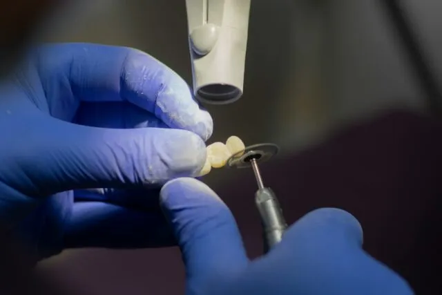 Photo dental tooth extraction procedure