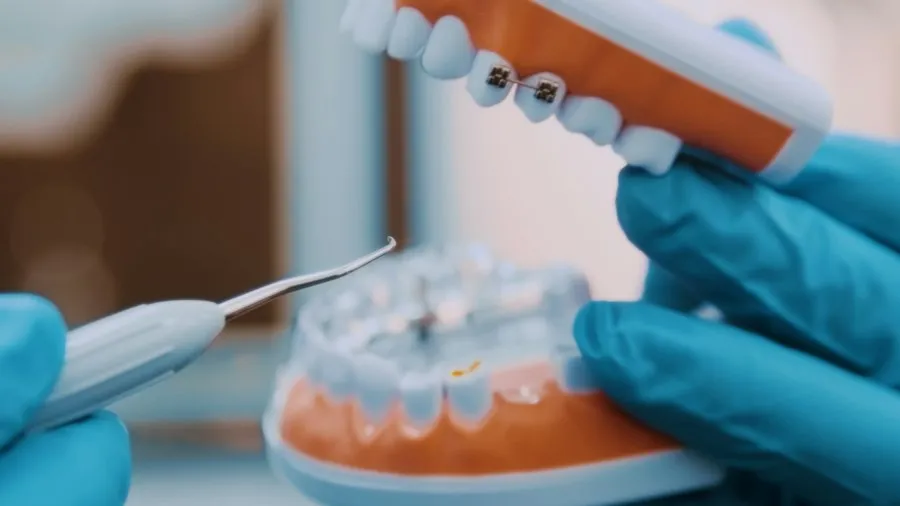 Photo dental tartar removal cleaning