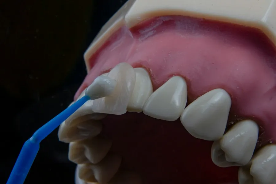 dental tartar removal cleaning