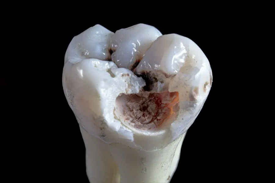 tooth decay prevention mistakes