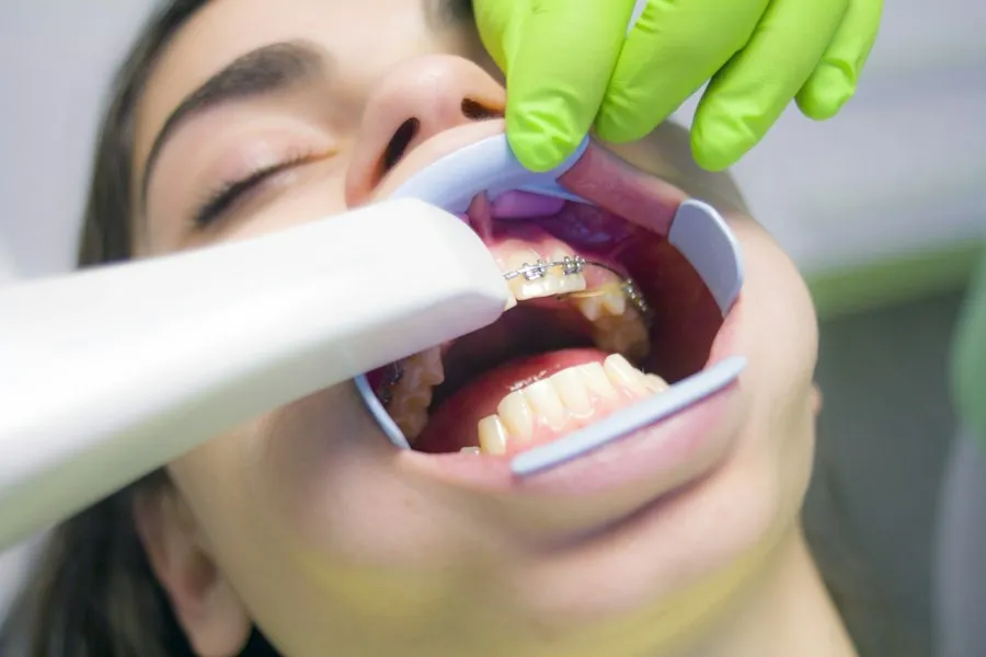 Photo dental filling mistakes