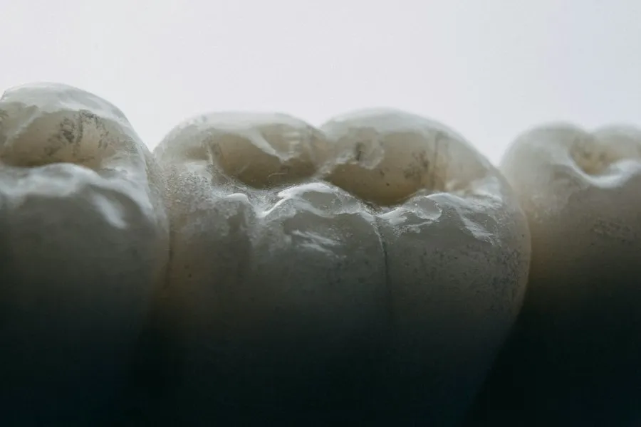 Photo dental tartar removal mistakes