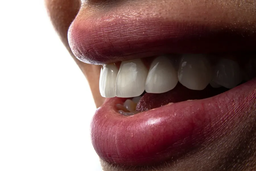 Photo common gingivitis mistakes