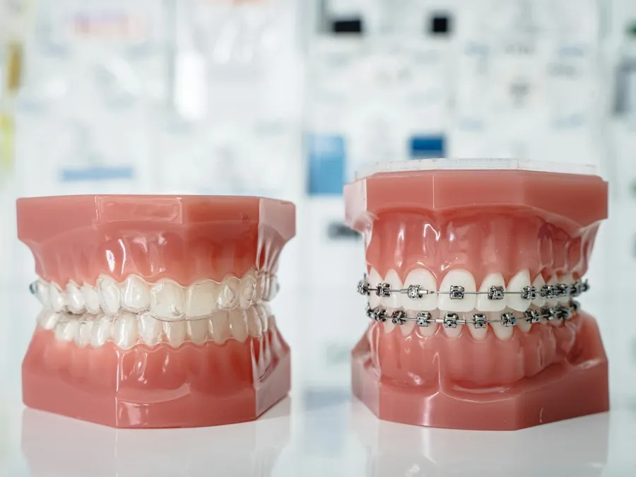 common orthodontic mistakes